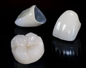 Ceramic Dental Crowns