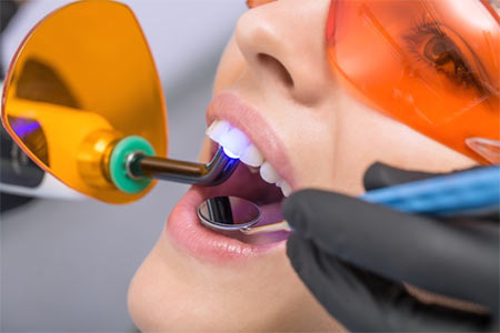 periodontal laser gums treatment Brooklyn NY