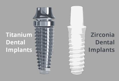 Titanium vs Zirconia Dental Implants Brooklyn