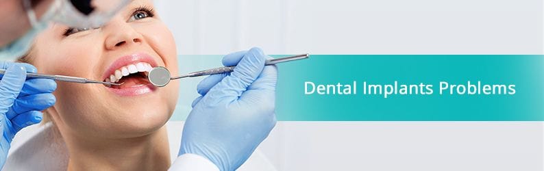 Dental Implant Problems | LuxDen Implants Center Brooklyn NY