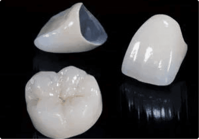 Dental Crowns Brooklyn - CEREC, PFZ, Zirconium, Ceramic Crowns