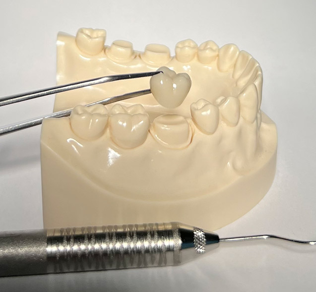 Dental Crown Treatment