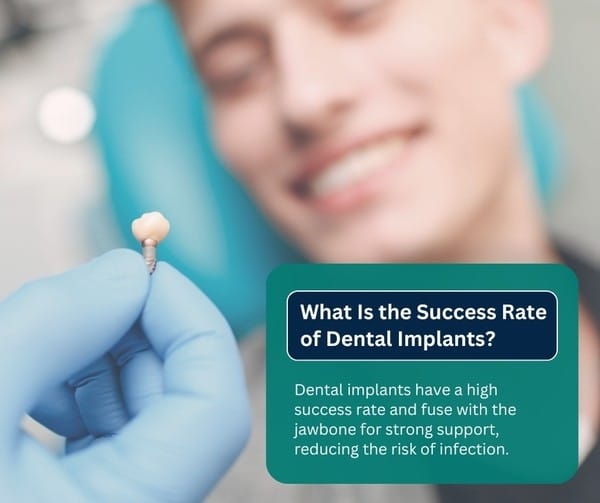 Success Rate of Dental Implants