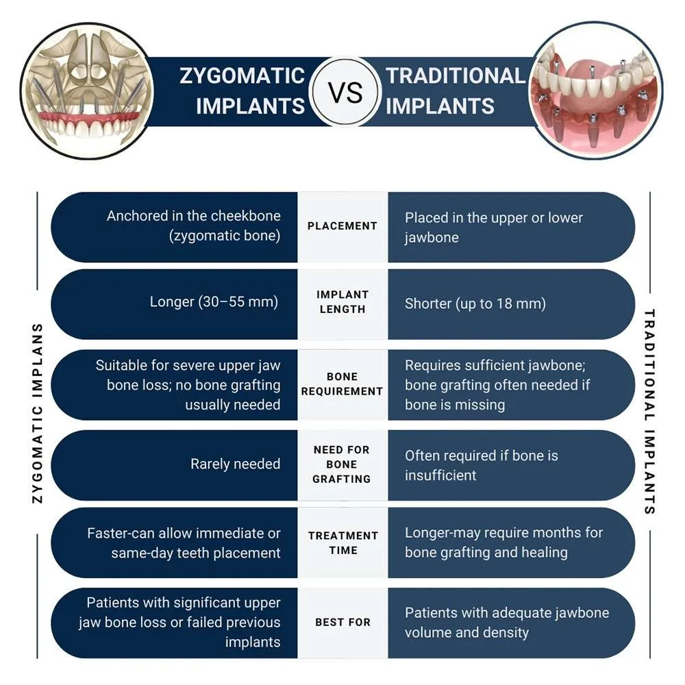 Zygomatic vs. Traditional Implants