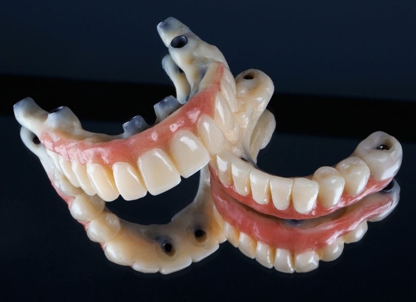 Dental Implants For Complete Tooth Loss in Brooklyn