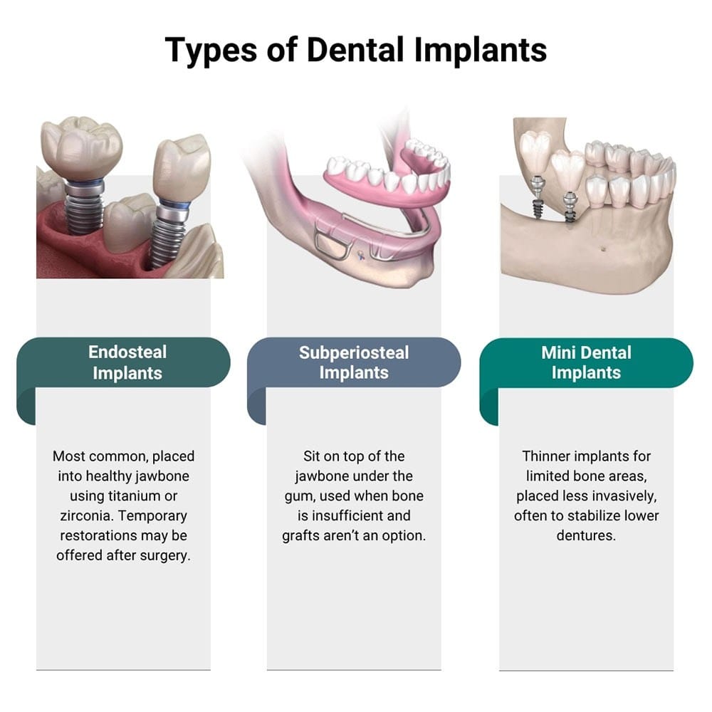 Types of Dental Implants