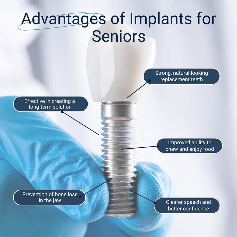 Advantages of Implants for Seniors