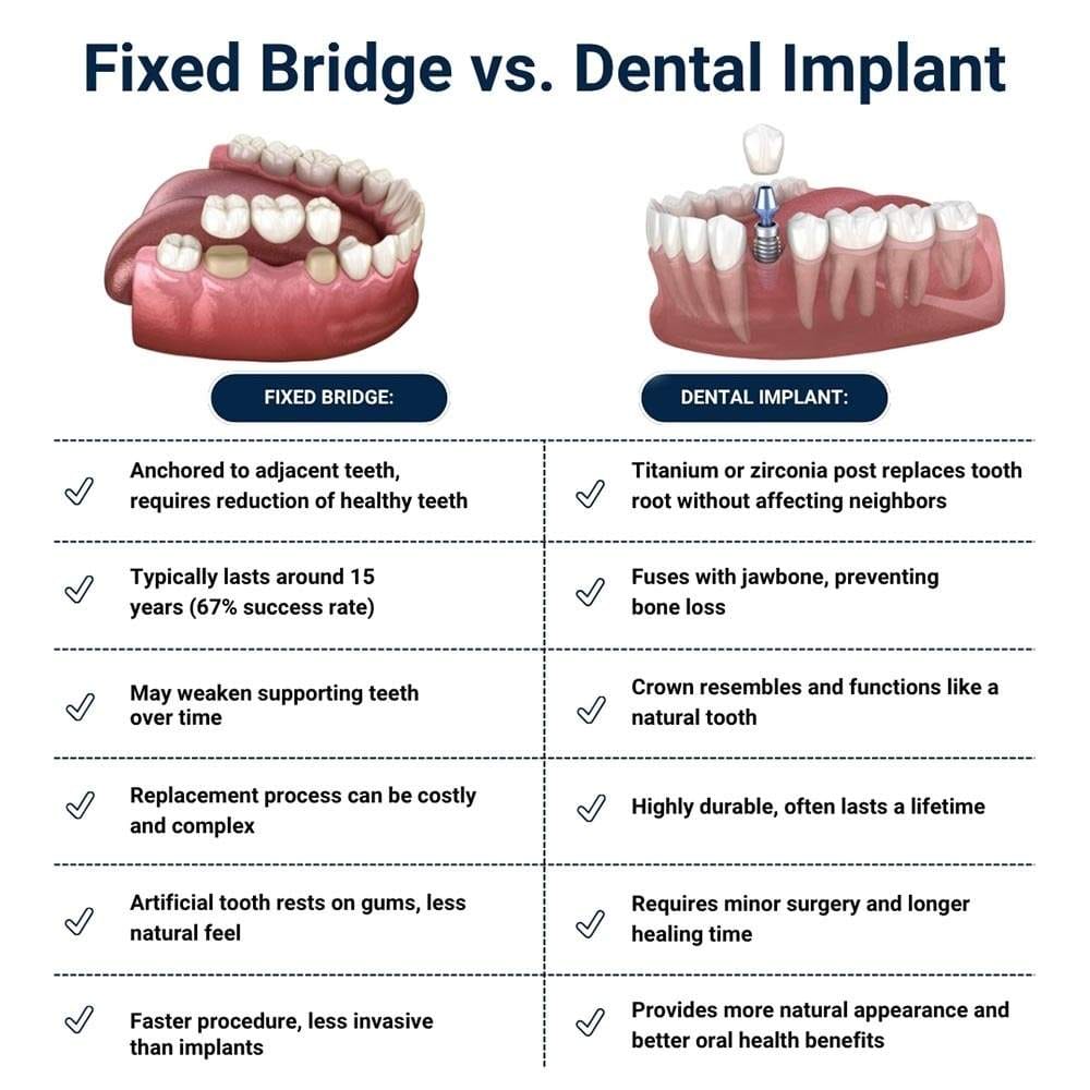 Fixed Bridge vs Dental Implant in Brooklyn
