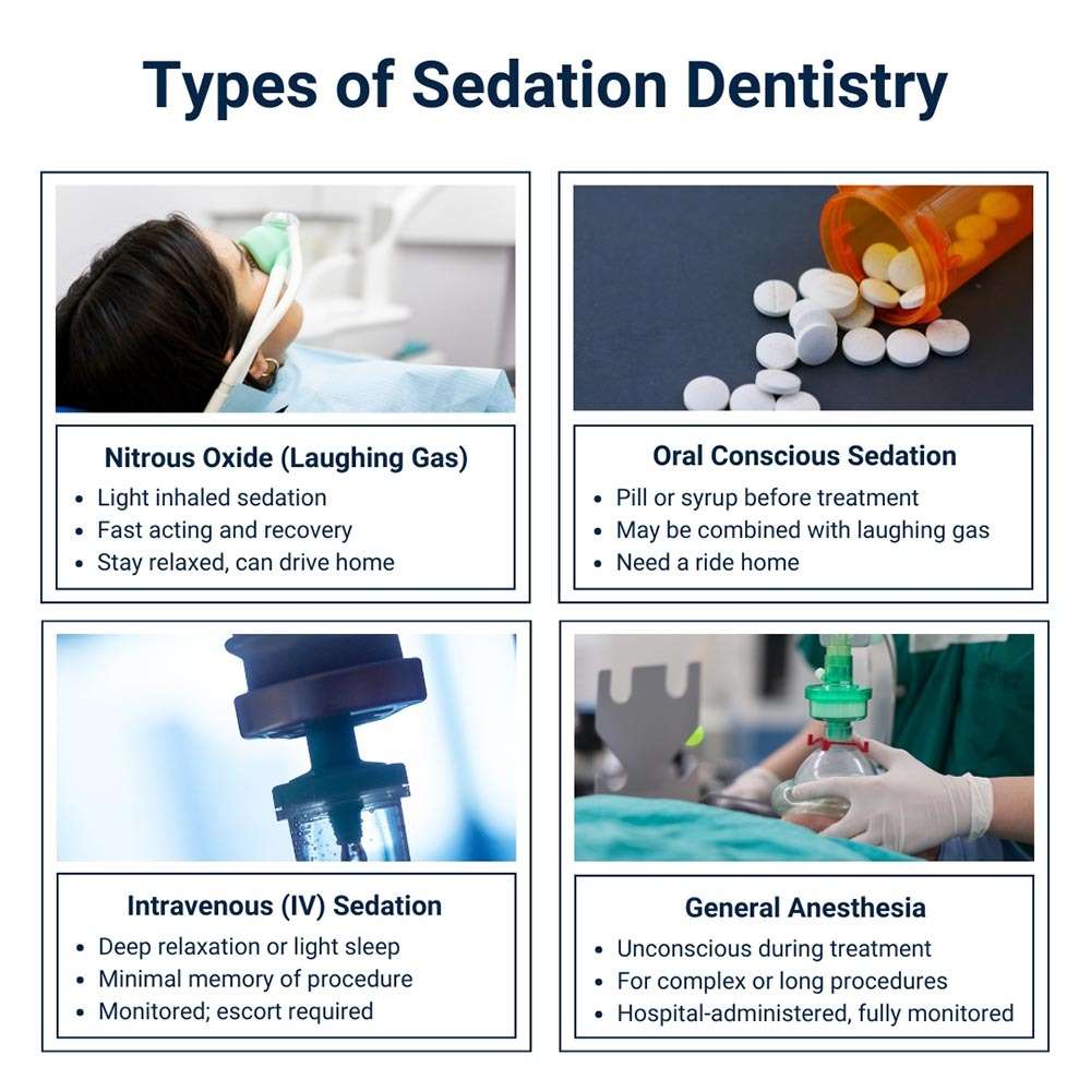 Types of Sedation Dentistry in Brooklyn