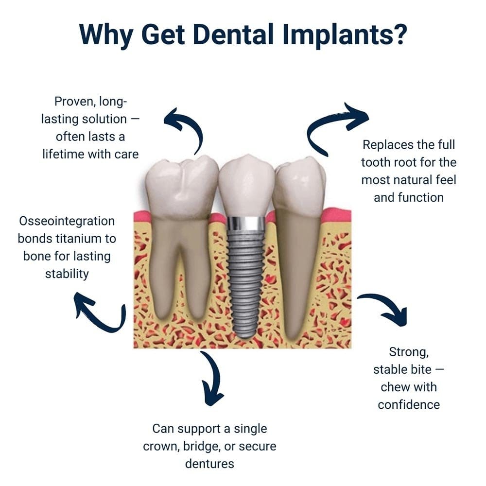 Why Get Dental Implants